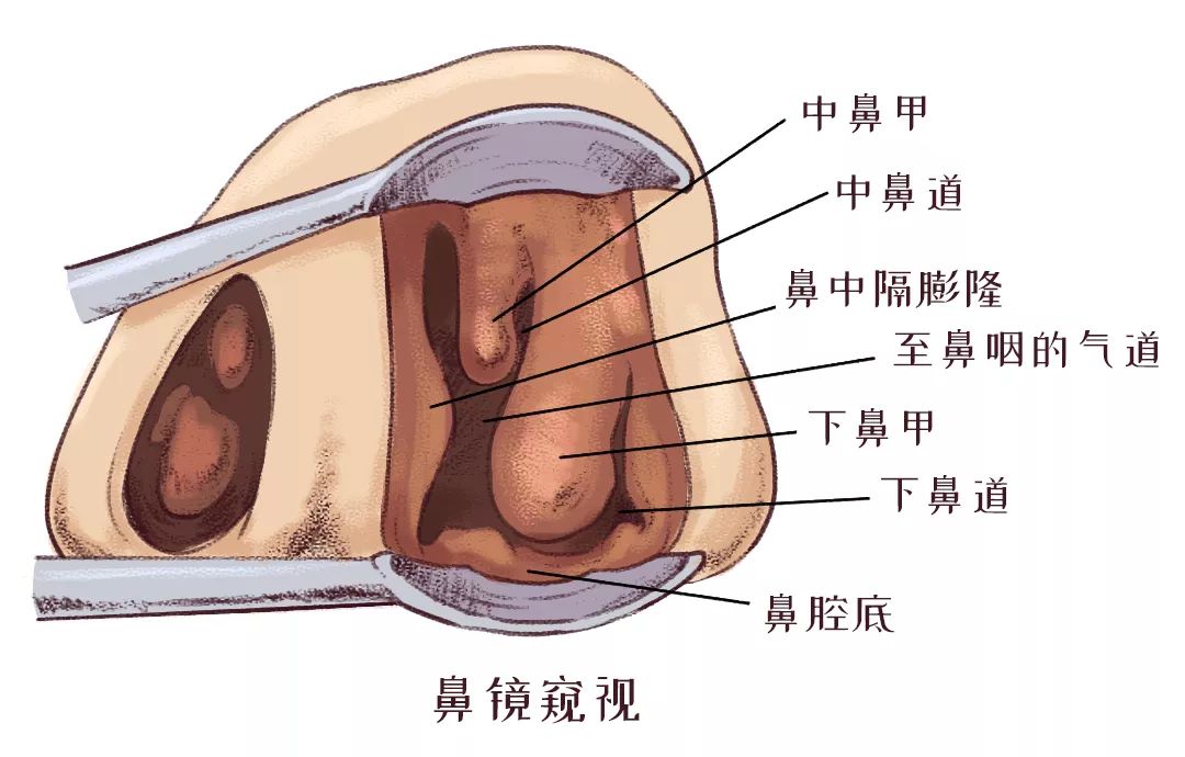 鼻甲肥大引起的呼吸困難怎么辦？(圖2)