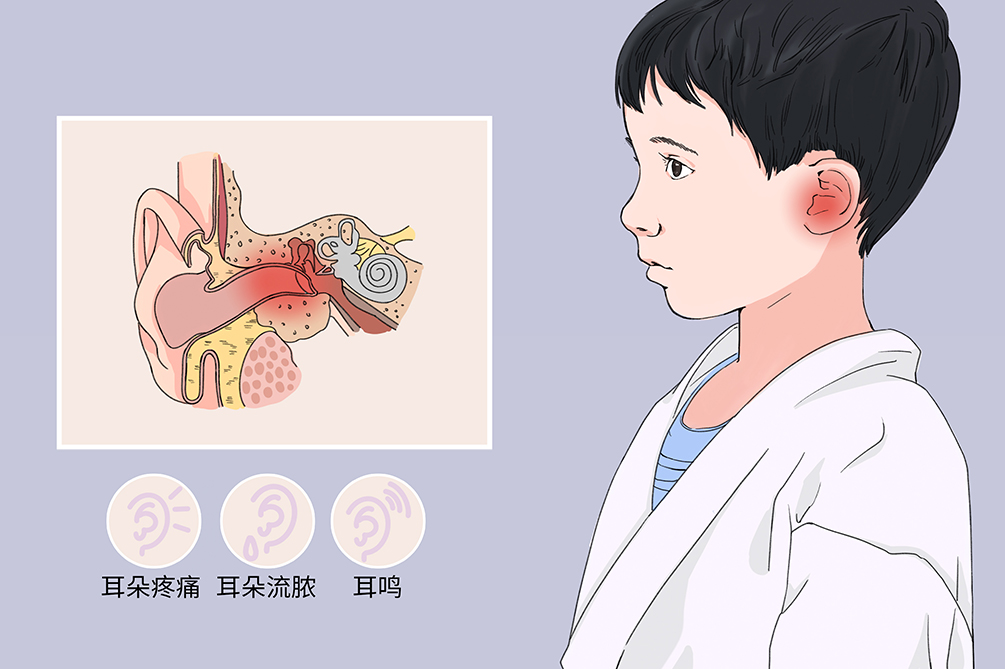 中耳炎雖小，但其危害不容小覷！(圖1)