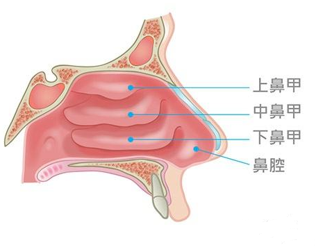 鼻甲肥大會引起面部結(jié)構(gòu)變化，還會導(dǎo)致眼袋、黑眼圈？(圖1)