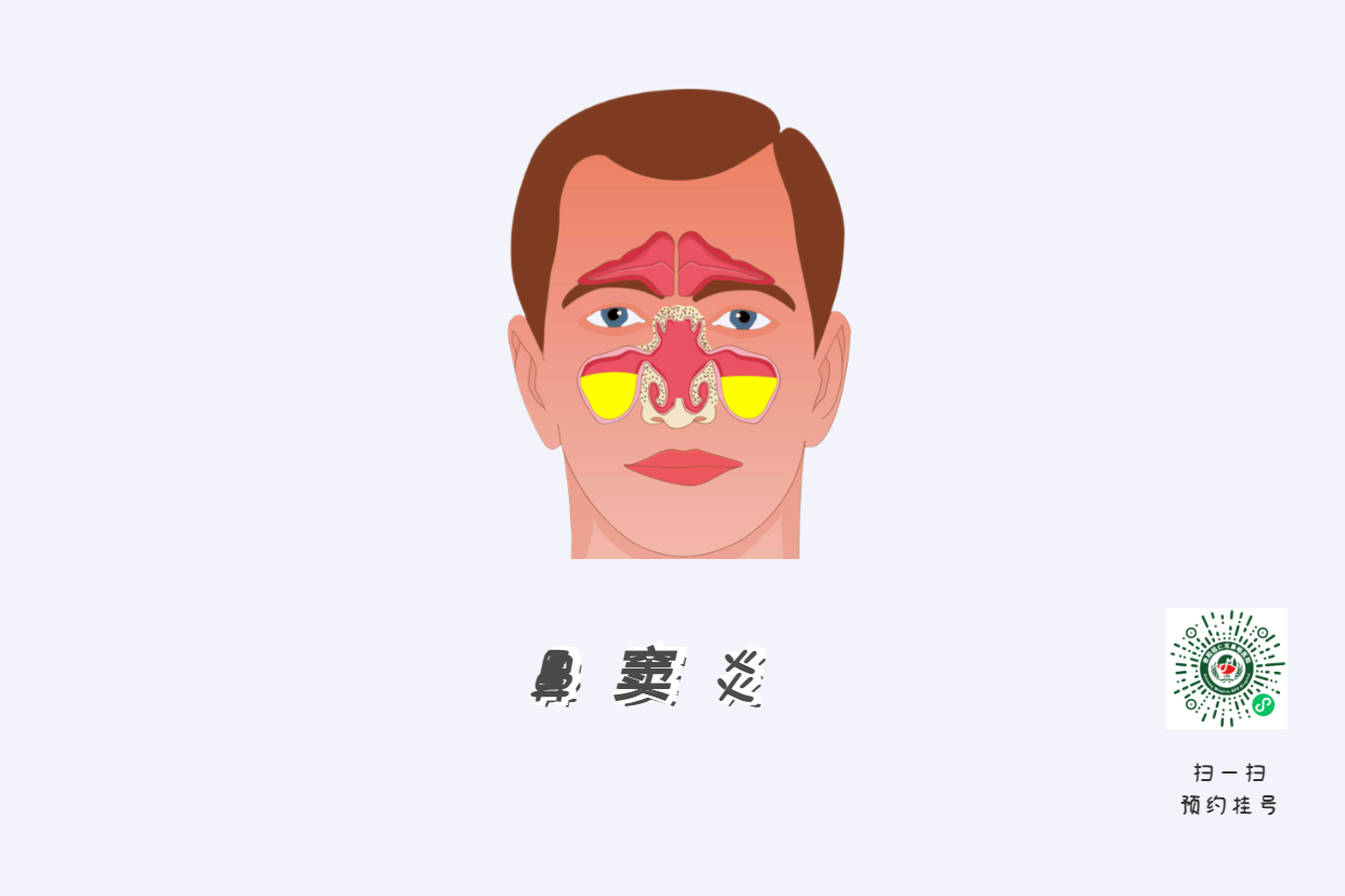 小兒鼻竇炎治療別拖延，越拖延越影響孩子的學(xué)習(xí)？(圖1)