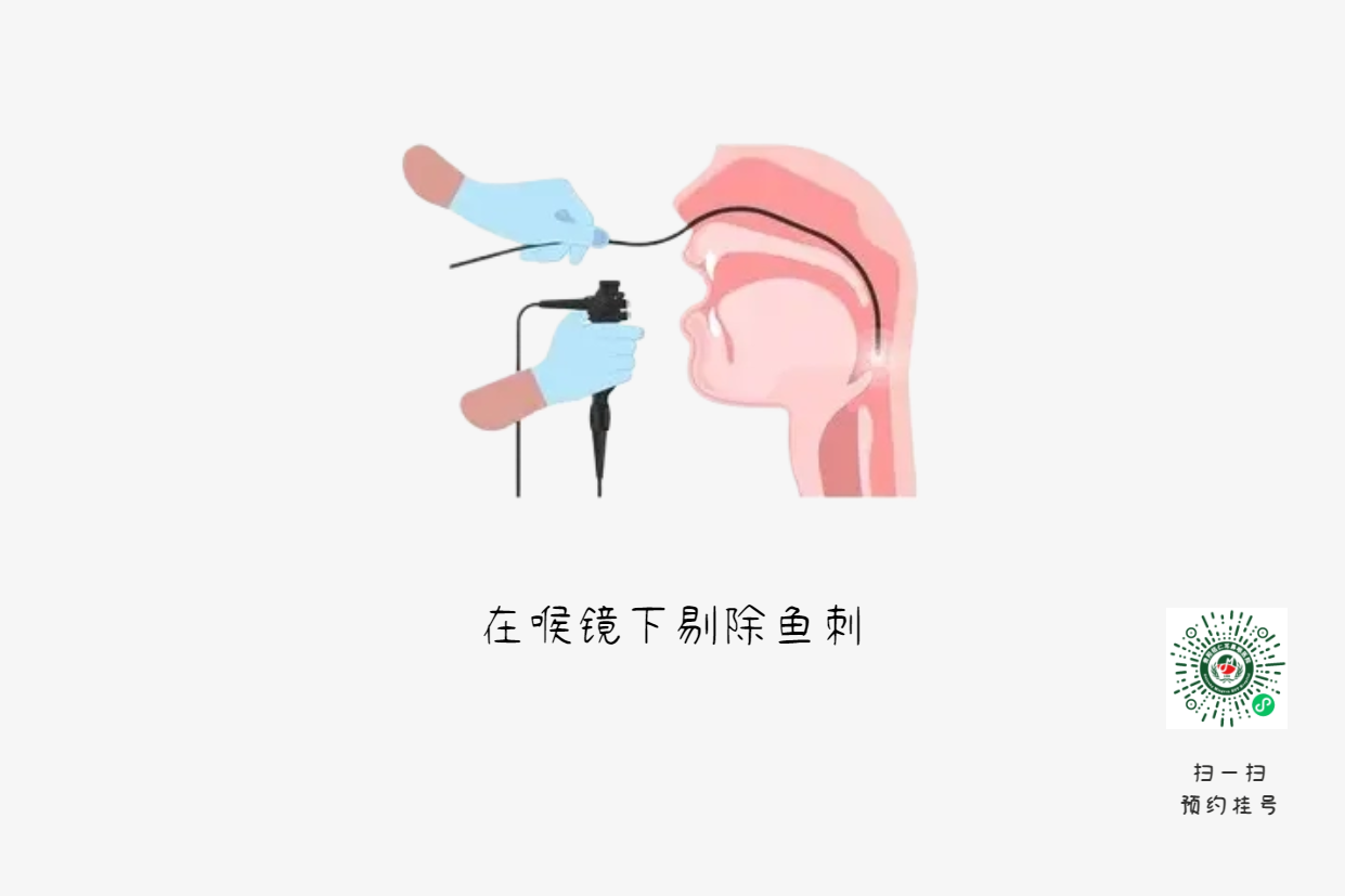 喉嚨卡魚(yú)刺？喝醋吞飯都是致命錯(cuò)誤(圖2)