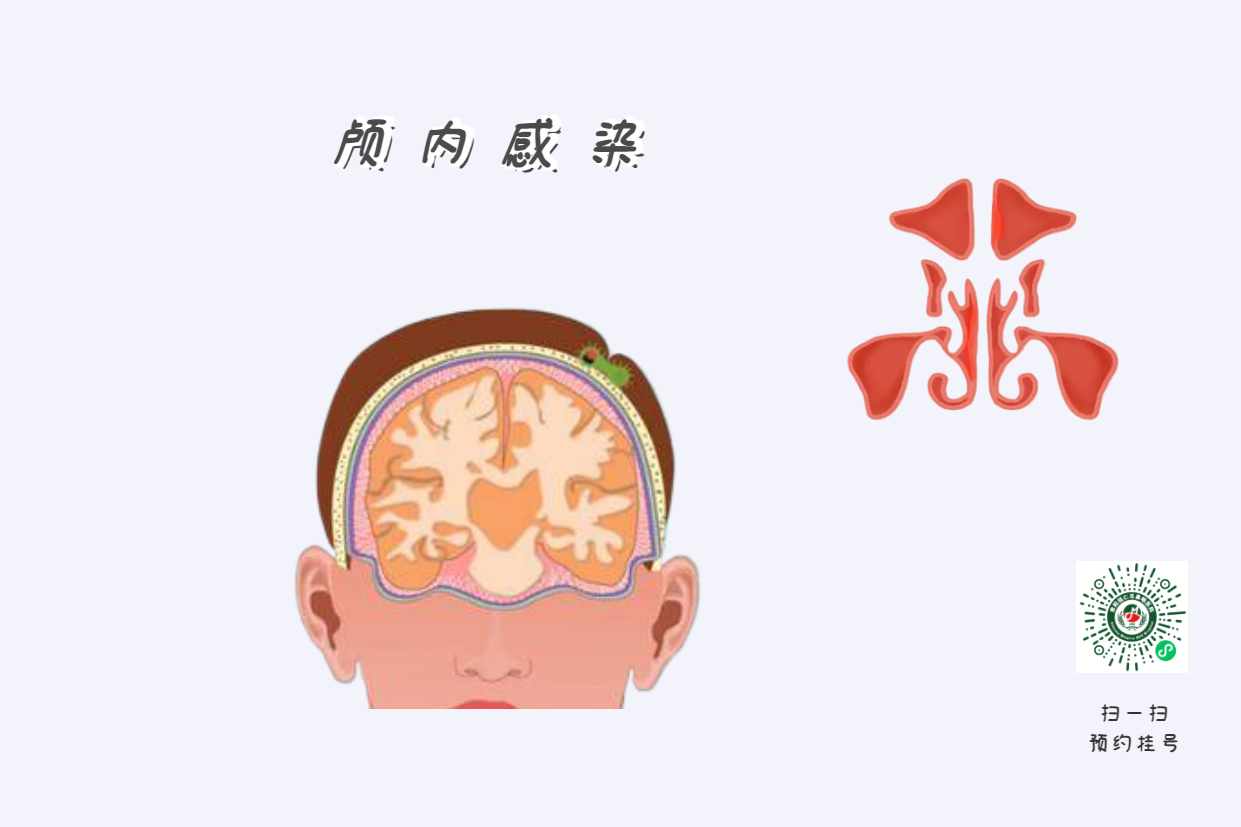 為什么患上鼻竇炎，會使孩子學(xué)習(xí)成績下降？(圖3)
