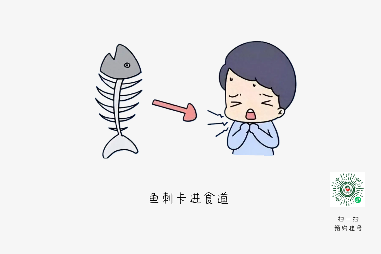 魚刺卡喉時(shí)，你的“土方法”可能讓情況更危險(xiǎn)(圖1)