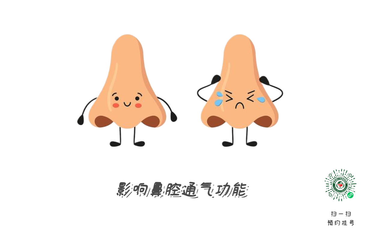 鼻中隔偏曲必須手術(shù)？符合這標(biāo)準(zhǔn)再?zèng)Q定(圖2)