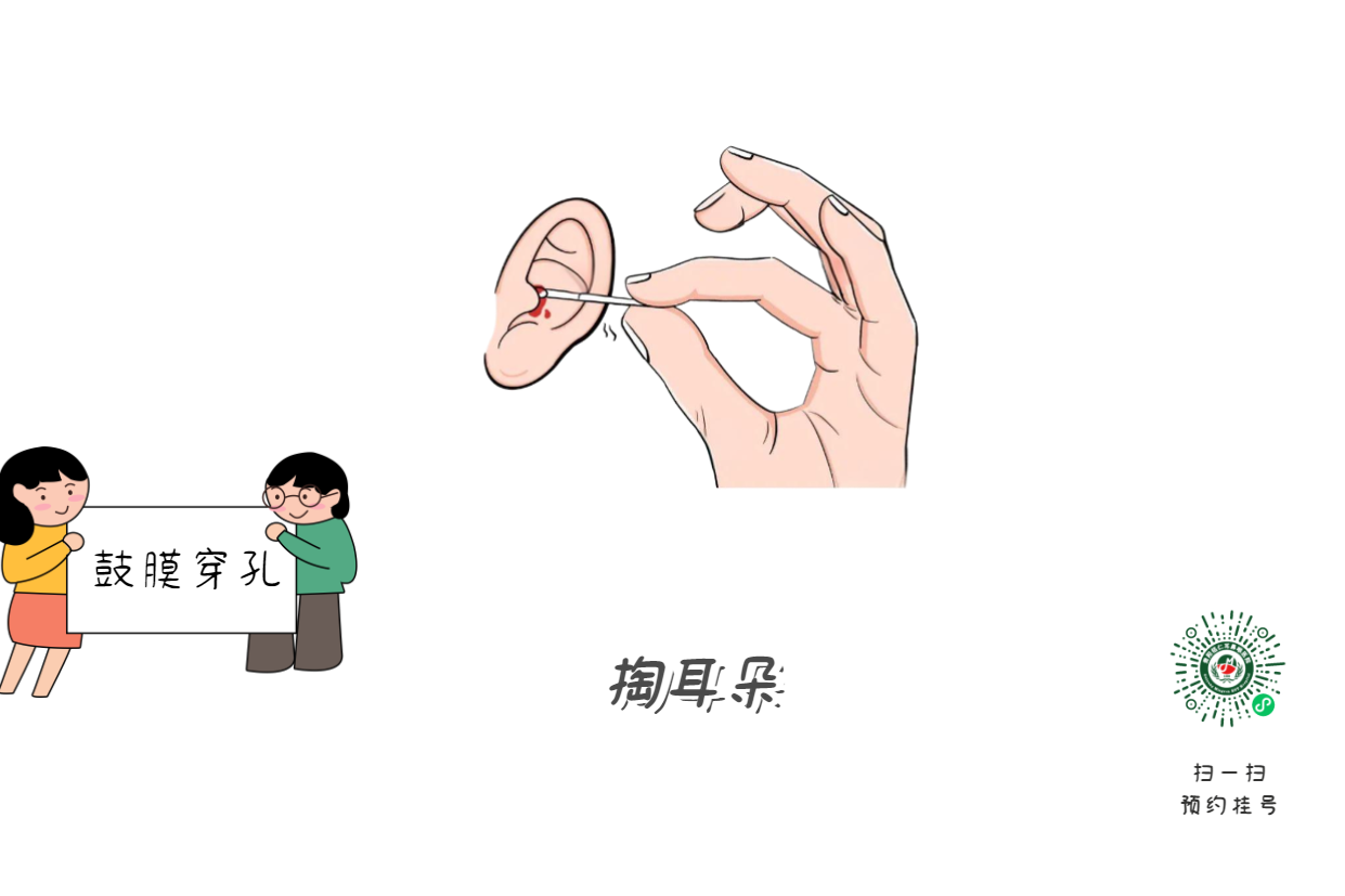 掏耳朵致鼓膜穿孔？這些動(dòng)作最危險(xiǎn)！(圖1)