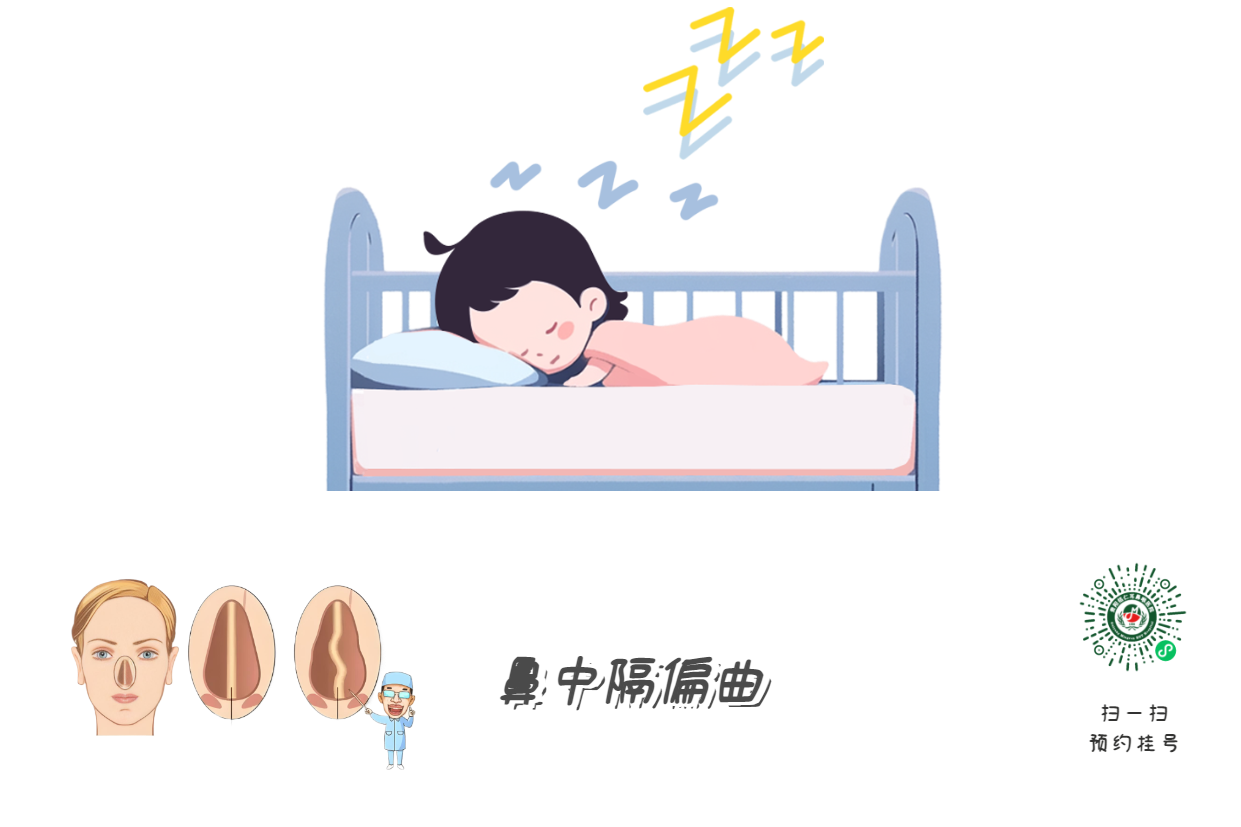 孩子打呼=睡得香？腺樣體警報(bào)！(圖3)