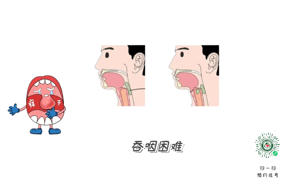 嗓子啞了別大意，可能是聲帶在“報警”(圖2)