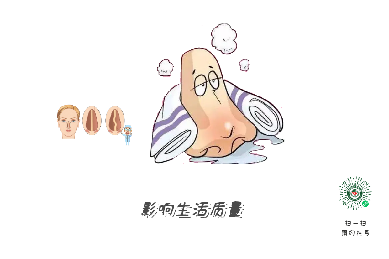 十年鼻塞不見好？問題可能出在“鼻梁歪了”！(圖3)