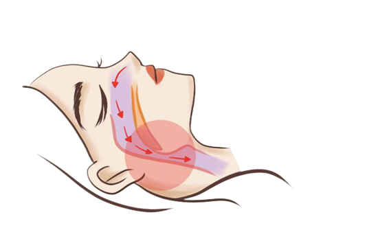 孩子睡覺打呼嚕？家長千萬別大意！(圖2)