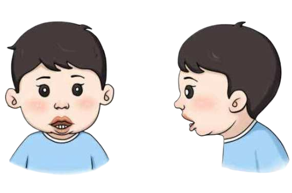 腺樣體影響智力？研究結(jié)果嚇壞家長(圖2)